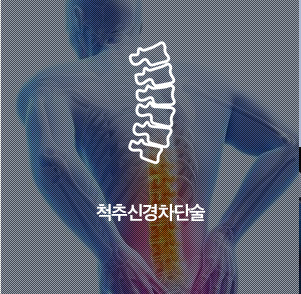 척추신경차단술